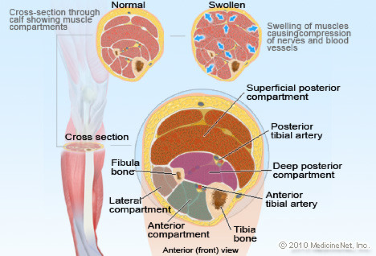 When Is Lower Leg Tingling Related to Vascular Issues? - StrideCare